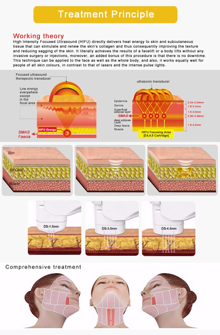HIFU for face & body-.png HIFU for face & body-.png