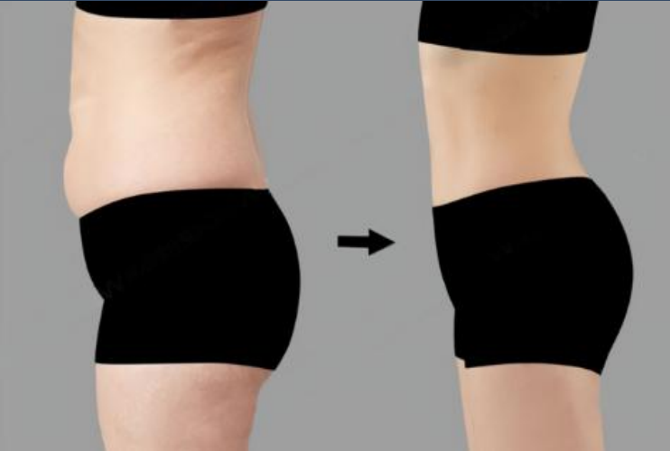 fat reduction.png